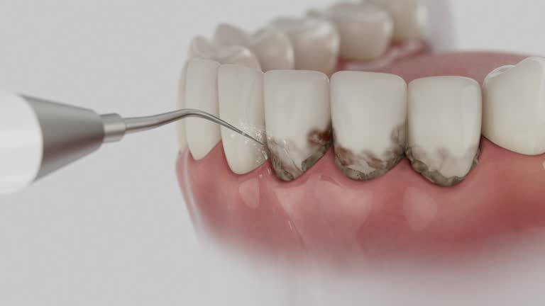 Reliable Dental contractor in Bonnetsville, NC by Dentist Open Now